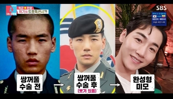 (사진=SBS ‘동상이몽 시즌2- 너는 내 운명’ 방송 갈무리)